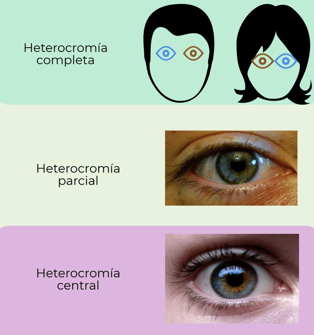 Abogados de herencia: ¿cuántas generaciones ignoran el color de ojos?