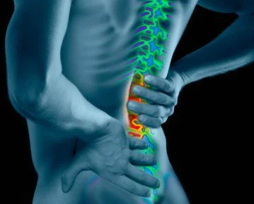Lumbalgia incapacitante: asesoría legal para conseguir compensación adecuada