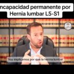 Derechos laborales: días de incapacidad por dolor de espalda