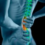 Discapacidad por lumbalgia: Asesoría legal con expertos